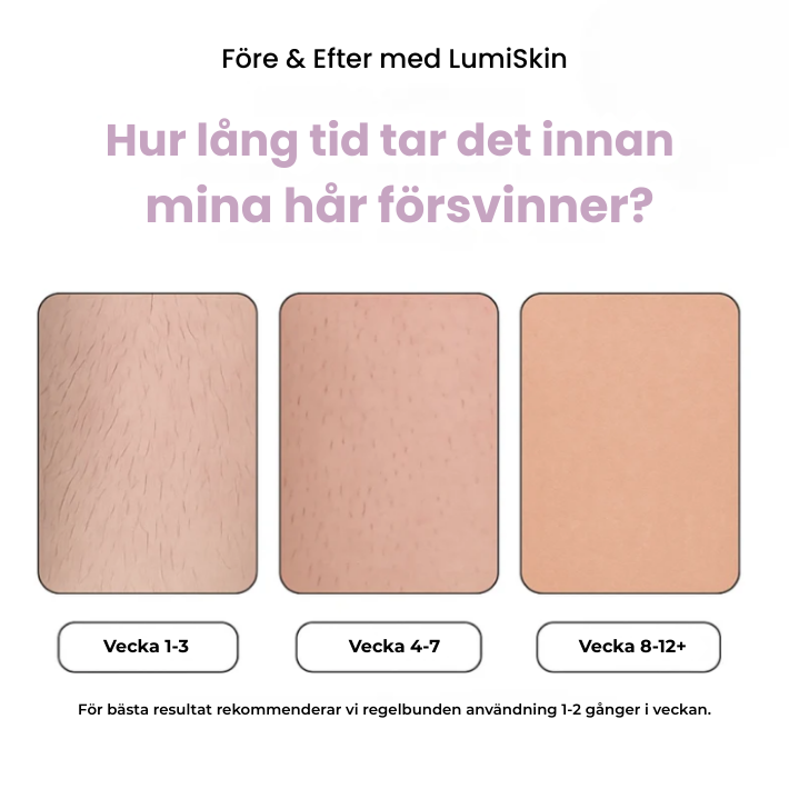 LumiSkin IPL – Slipp hår permanent hemma