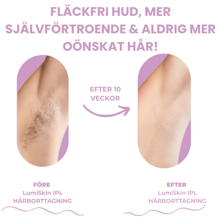 LumiSkin IPL – Slipp hår permanent hemma